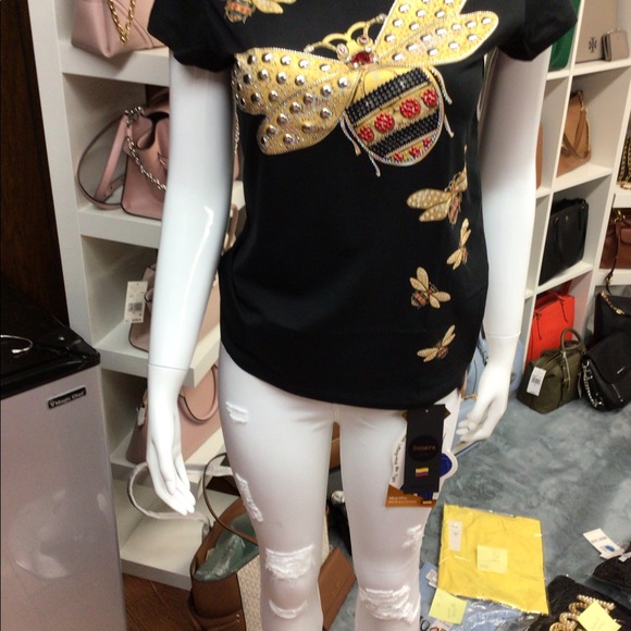 Butt Lifting - Picture 7 of 10